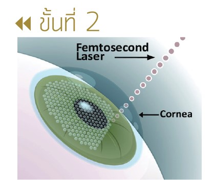 Femtosecond Laser